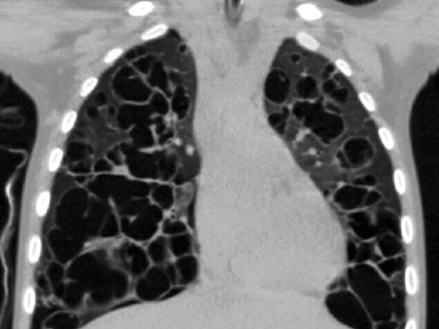 Blog childhood cancer awareness 4 - Image in article: Childhood Cancer Awareness Month