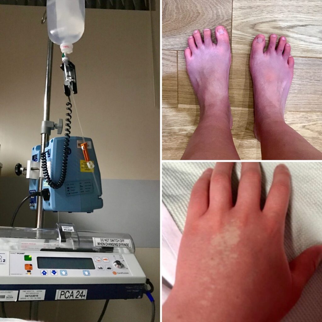 Blog dysautonomia awareness month 2 - Image in article: Understanding Dysautonomia: Raising Awareness This October